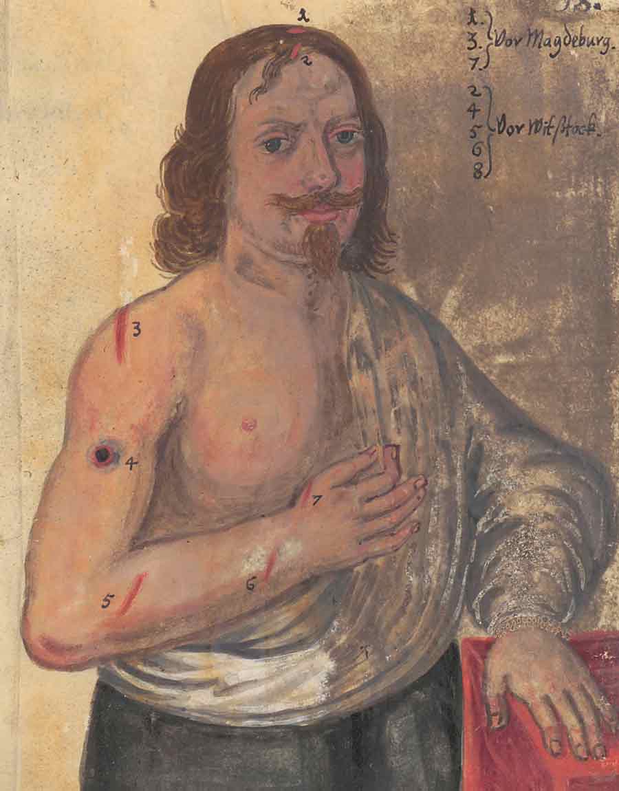 Daniel Hubatka, former soldier, Documentation of war injuries, 1655   Sächsisches Staatsarchiv - Hauptstaatsarchiv Dresden 